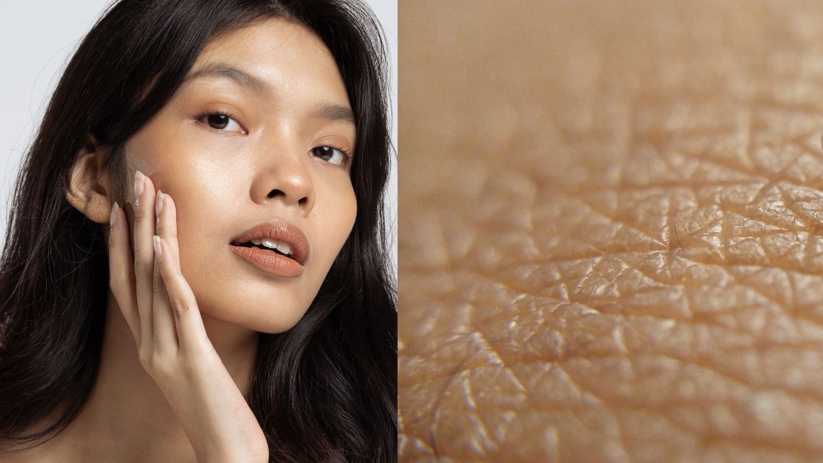 Better skin: Lifestyle changes to make