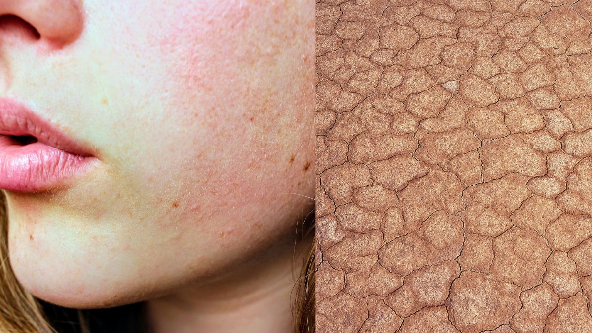 The Ultimate Skincare Routine for Dry Skin Types: Tips for a Healthy, Glowing Complexion