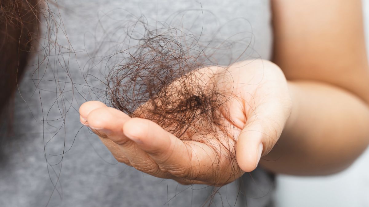 Hair Loss Treatments: Understanding Your Options