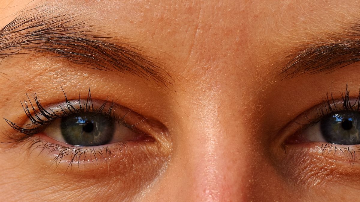 How to reduce puffiness and dark circles under your eyes