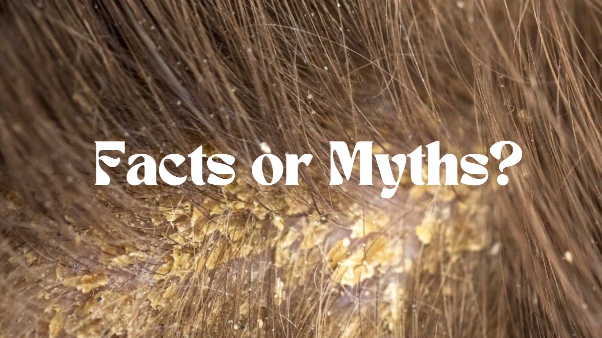 The Truth About Dandruff: Debunking Common Myths and Misconceptions